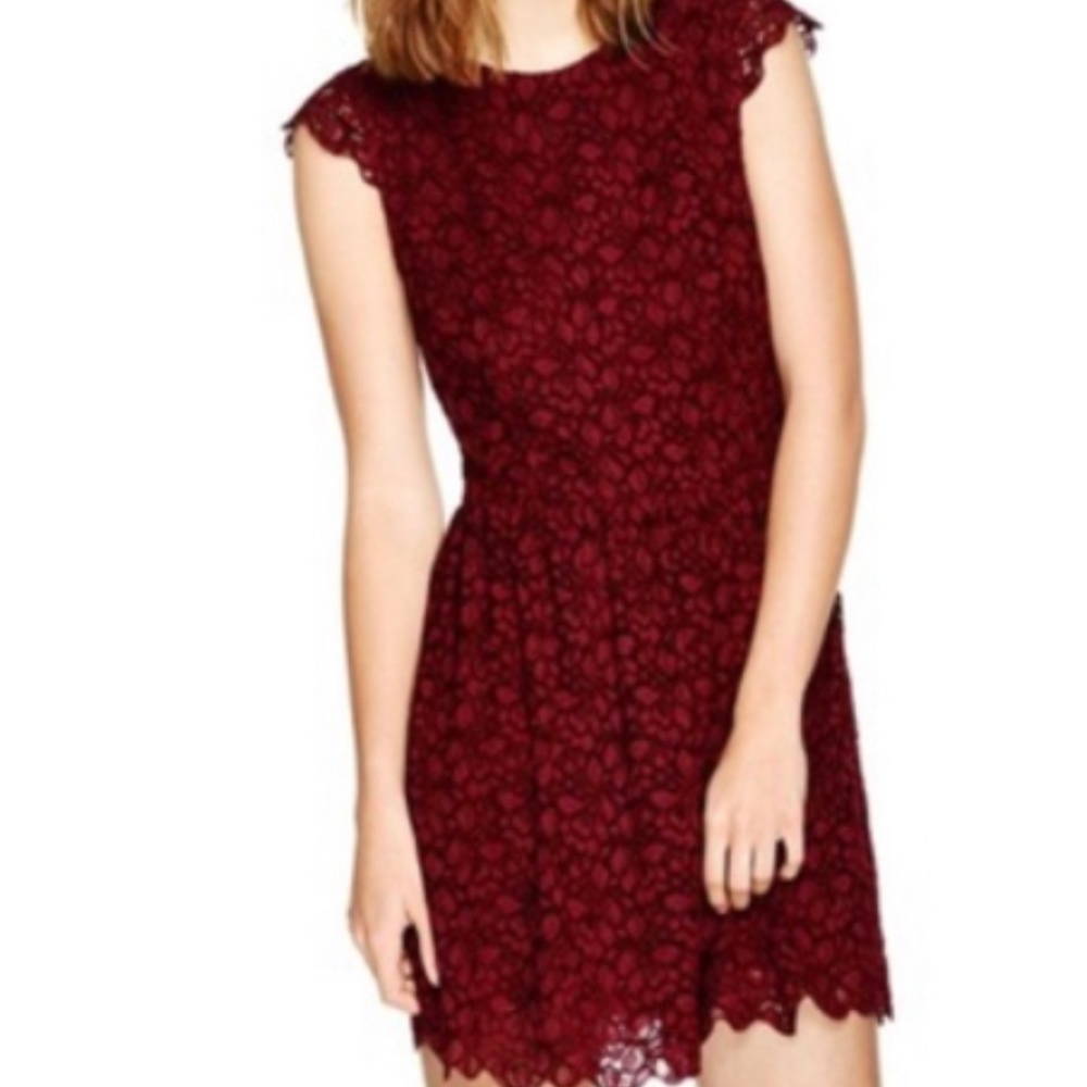 Aritzia Lace Dress